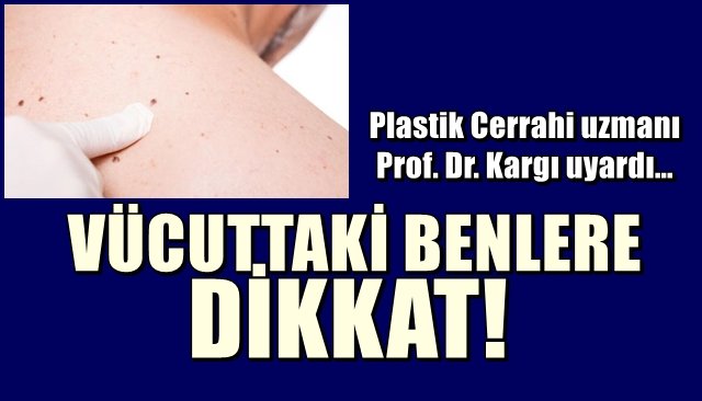 Plastik Cerrahi uzmanı Prof. Dr. Kargı uyardı… VÜCUTTAKİ BENLERE DİKKAT!