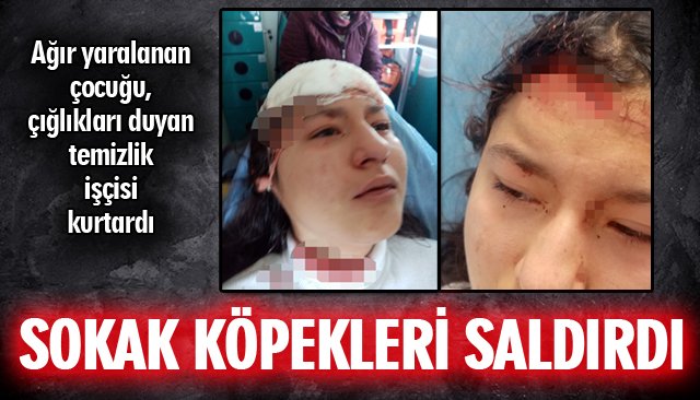 ÖZ ÇEKİM YAPAN ÇOĞUĞU, SOKAK KÖPEKLERİ ISIRDI