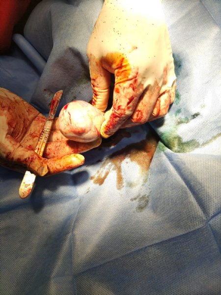 Tümörden kurtuldu, hayata geri döndü - 3