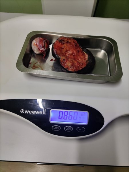 Tümörden kurtuldu, hayata geri döndü - 5