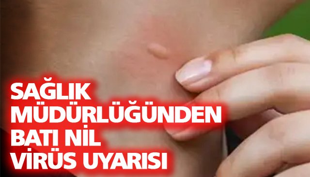 VİRÜS UYARISI!