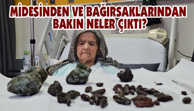 MİDESİNDEN VE BAĞIRSAKLARINDAN BAKIN NELER ÇIKTI?