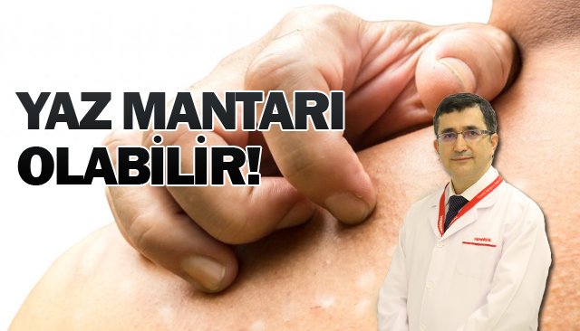 Tinea versikolor nedir?
