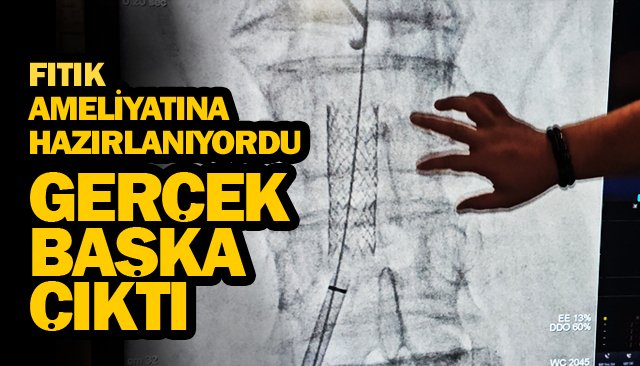 FITIK AMELİYATINA  HAZIRLANIYORDU  GERÇEK BAŞKA ÇIKTI