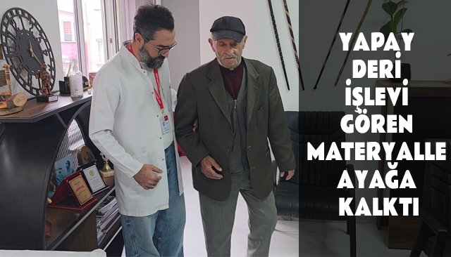 YAPAY DERİ İŞLEVİ GÖREN MATERYALLE AYAĞA KALKTI