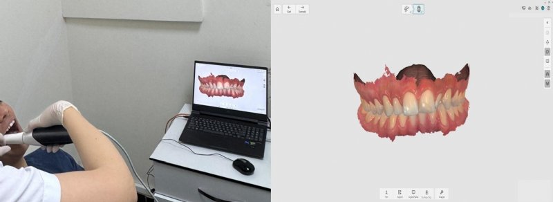 Zonguldak’ta Modern Ortodontik Tedavi Dönüşümü - 2