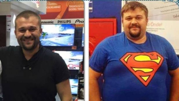 Bir yılda 80 kilo verdi hayatı değişti